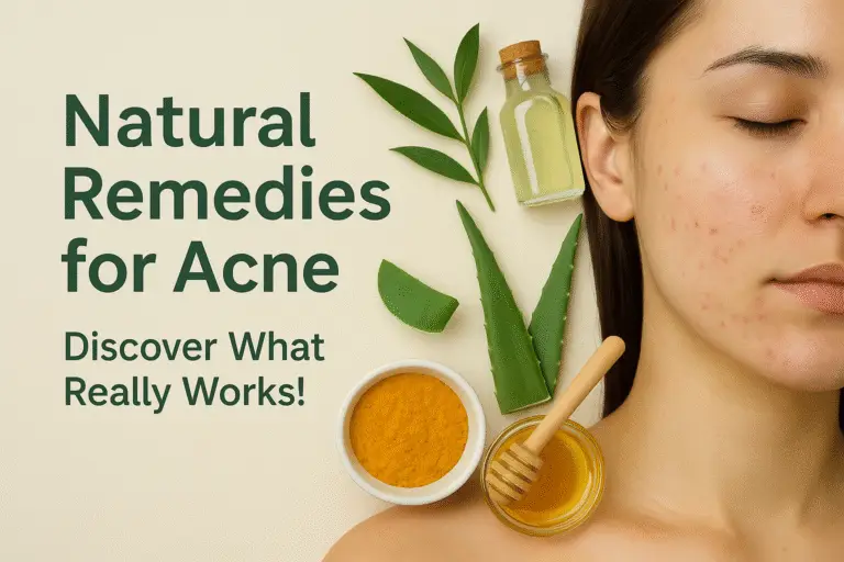 Natural Remedies for Acne What Works